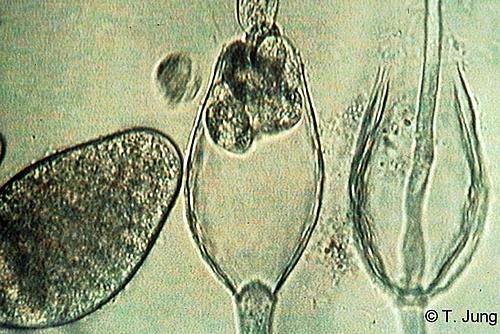 Phytophthora Fotogalerie - Buche, Bild beech24.jpg