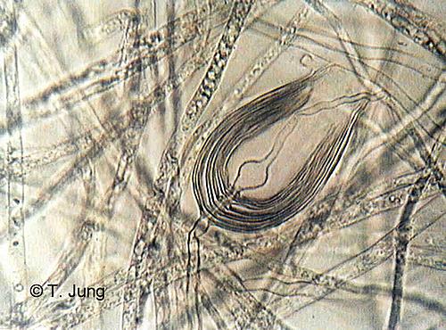 Phytophthora Fotogalerie - Buche, Bild beech25.jpg