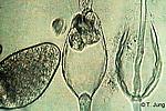 Phytophthora Fotogalerie - Buche, verkleinertes Vorschaubild und Link zu beech24.jpg